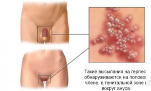Treatment of genital herpes in women