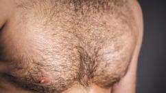 Issues of chest hair growth in women and girls