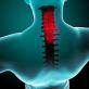 Muscles in the neck are tense Muscle spasm of the neck symptoms