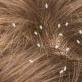 Can lice appear on nerves in an adult?